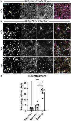 SARM1 Depletion Slows Axon Degeneration in a CNS Model of Neurotropic Viral Infection